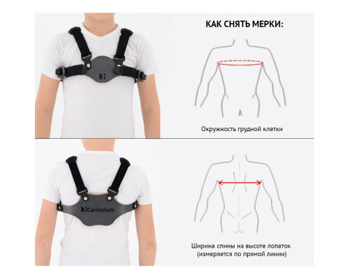 Детский ортез на клиновидную грудь Reh4Mat Carinatum AM-TX-04