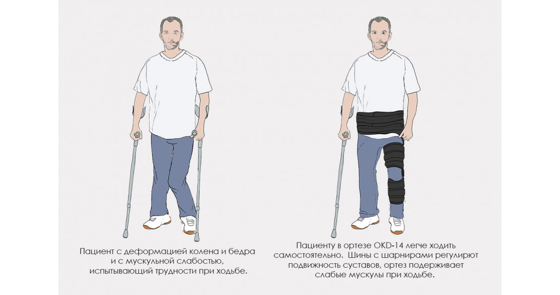 Ортез Reh4mat. Коленно-бедренный ортез с регулировкой подвижности односторонний Reh4Mat Okd-14